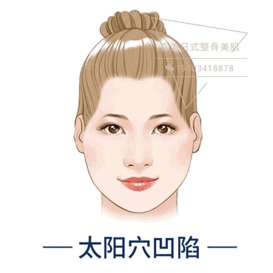 太原現(xiàn)！日式整骨小臉術(shù)！大V明星爆紅全靠它~