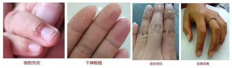 精油手套+足套SPA每天30分鐘還你柔嫩手足死皮粗糙走光光