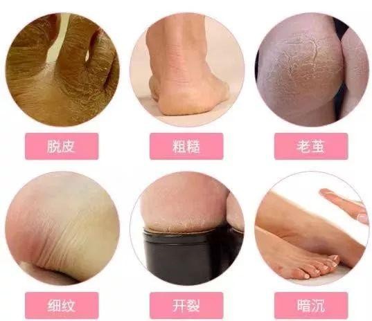 精油手套+足套SPA每天30分鐘還你柔嫩手足死皮粗糙走光光