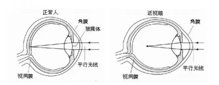 歐普康視——幫眼睛做個(gè)SPA毛利堪比茅臺(tái)