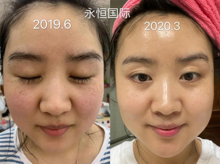 頭條！涂抹式微整護(hù)膚品進(jìn)駐張家界！