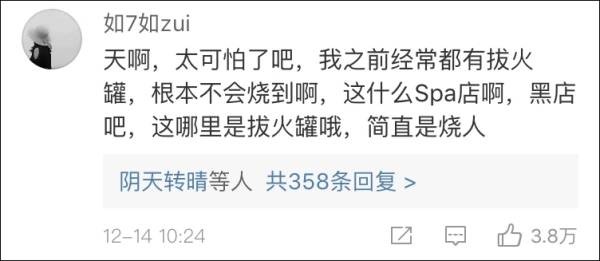 女演員在SPA店拔火罐被嚴重燒傷