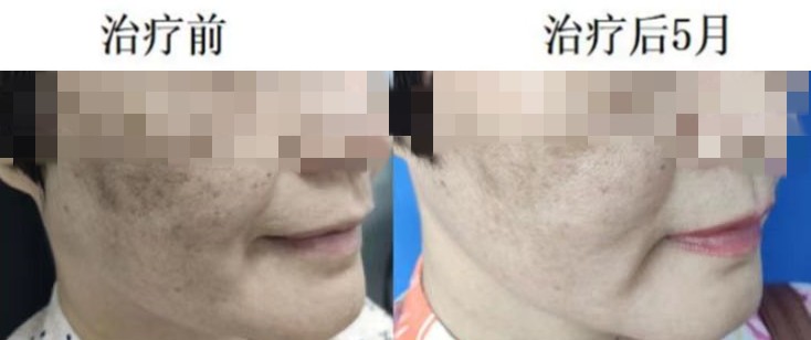 抗衰老一針年輕十歲福建專家告訴你真正的干細(xì)胞治療是怎樣的丨大醫(yī)生開(kāi)講